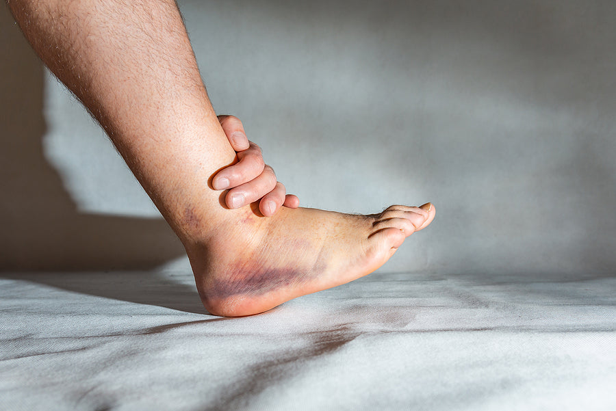 What should I do when I sprain my ankle?